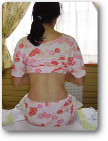 １回目ビフォー